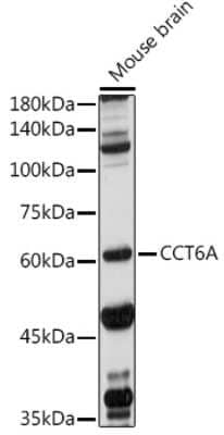 Western Blot: CCT6A AntibodyBSA Free [NBP2-92778]